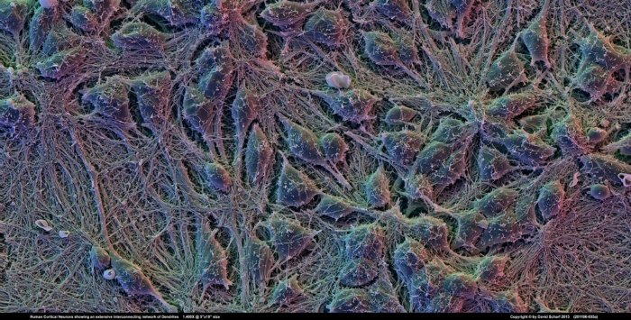 201106-035a-Neurons1