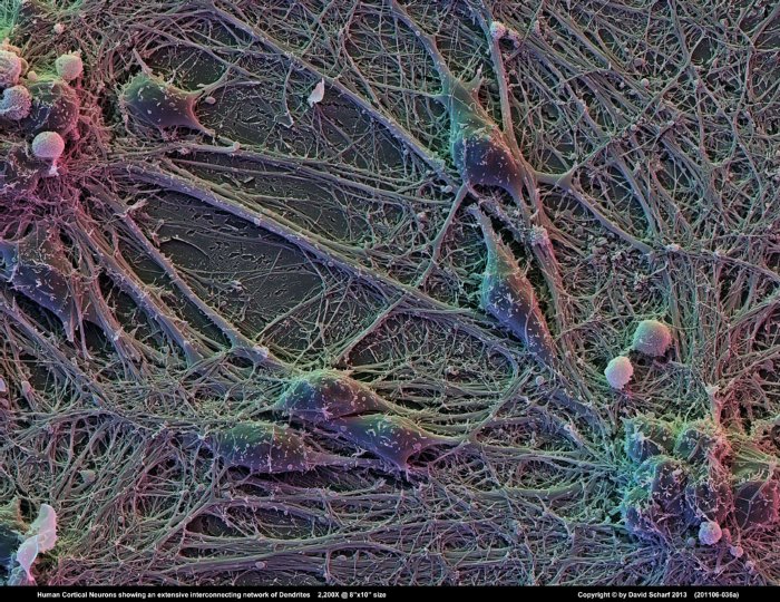 201106-036a-Neurons1