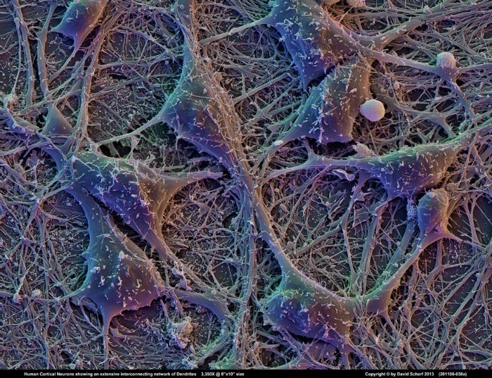 201106-038a-Neurons1