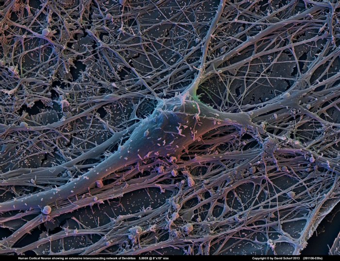 201106-039a-Neuron1