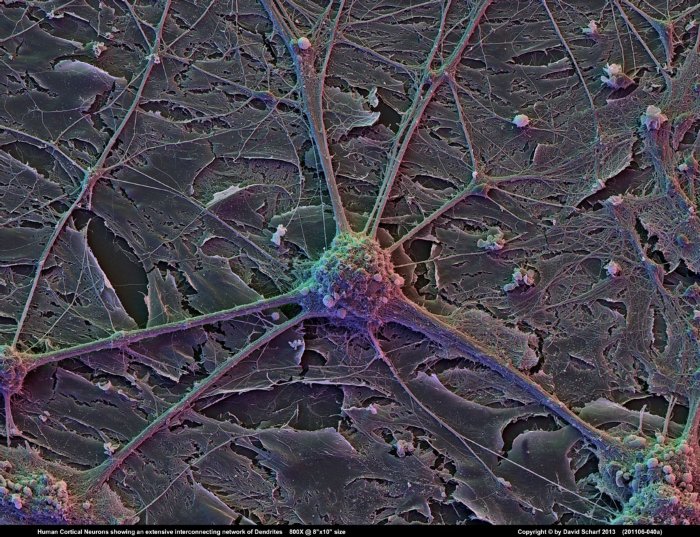 201106-040a-Neurons1