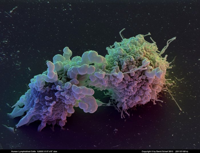 201107-001a-Lymphoblast-Cells1