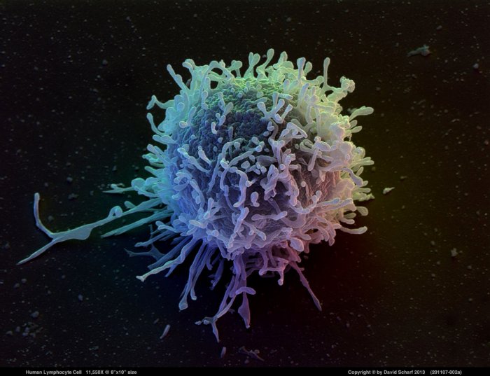 201107-002a-Lymphocyte-Cell1