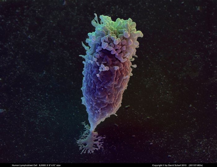 201107-003a-Lymphoblast-Cell1