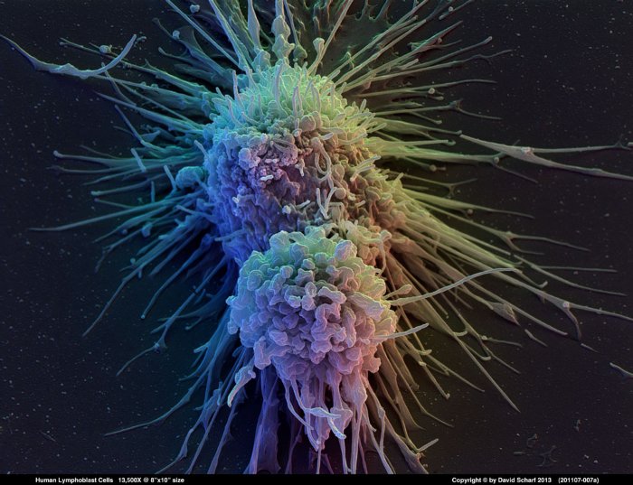 201107-007a-Lymphoblast-Cells1