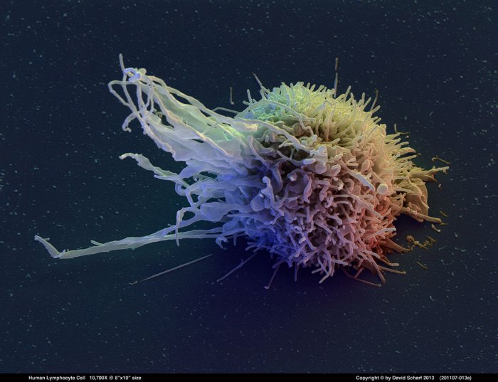 201107-013a-Lymphocyte-Cell1