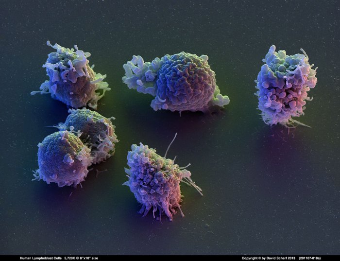 201107-018a-Lymphoblast-Cells1
