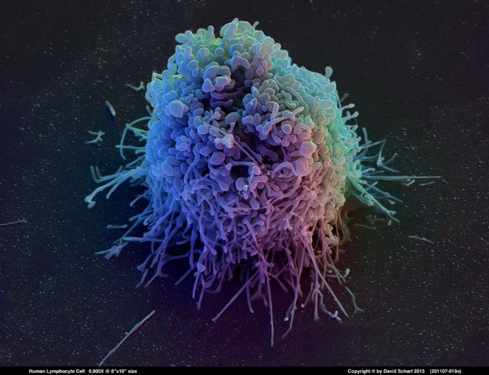 201107-019a-Lymphocyte-Cell1