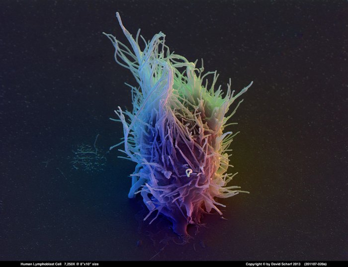 201107-020a-Lymphoblast-Cell1