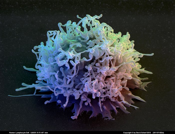 201107-022a-Lymphocyte-Cell1