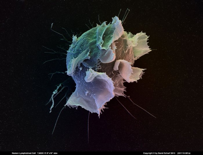 201110-001a-Lymphoblast-Cell1