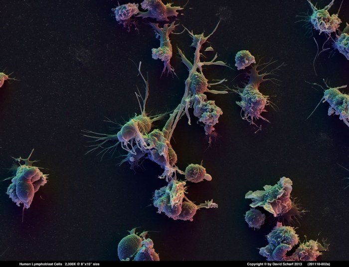 201110-002a-Lymphoblast-Cells1