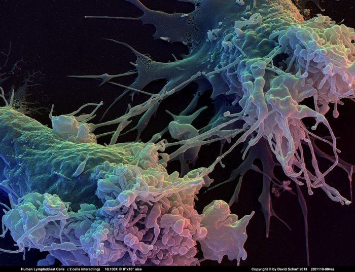 201110-004a-Lymphoblast-Cells1