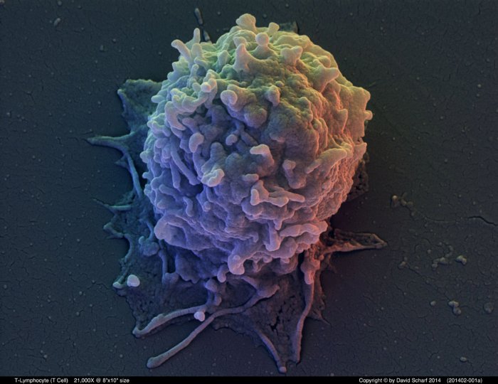 201402-001a-T-Cell1