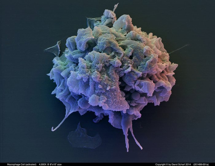 201406-001a-Macrophage-Cell1