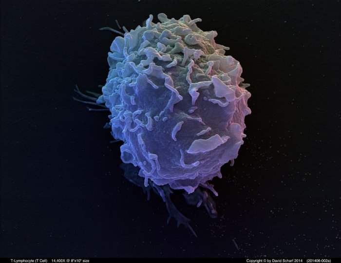 201406-002a-T-Cell1