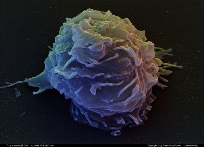 201406-003a-T-Cell1