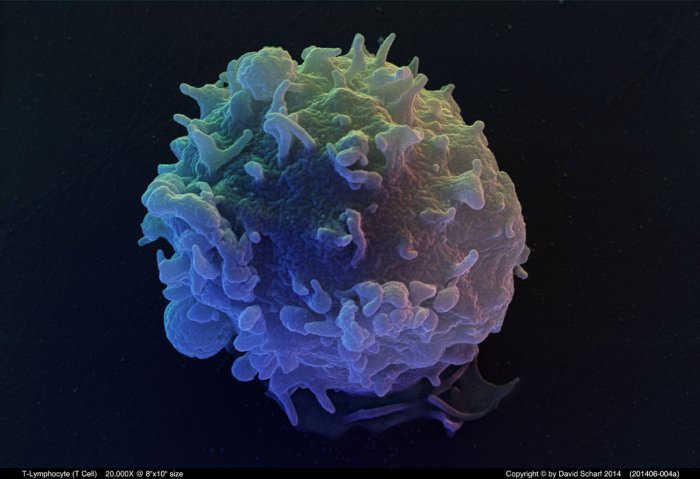 201406-004a-T-Cell1