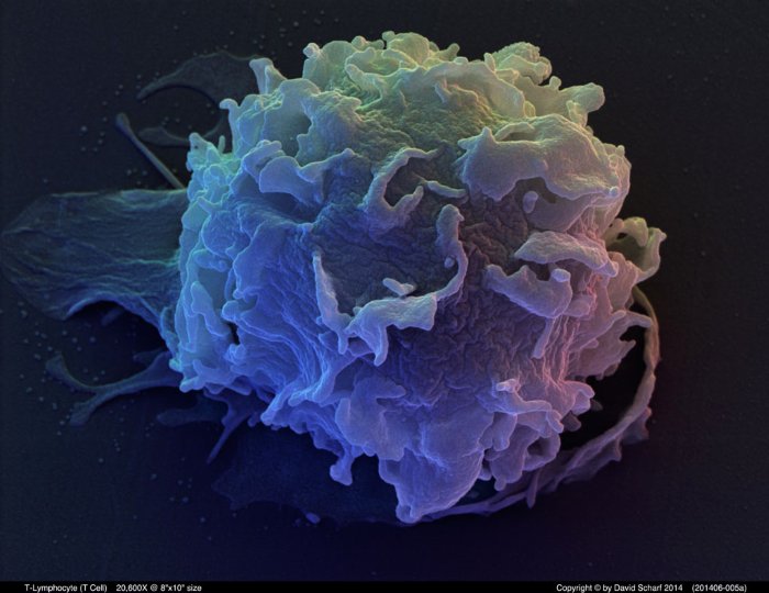 201406-005a-T-Cell1