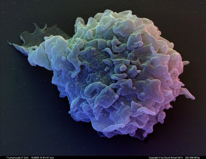 201406-007a-T-Cell1