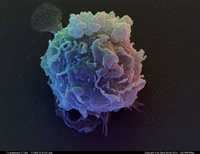 201406-009a-T-Cell1