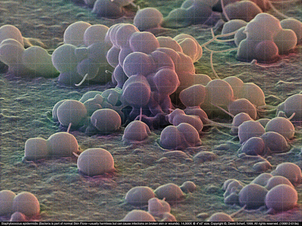 Бактерии staphylococcus aureus. Золотистый стафилококк эпидермальный. S. aureus золотистый стафилококк. Эпидермального стафилококка. Эпидермальный стафилококк Staphylococcus epidermidis.