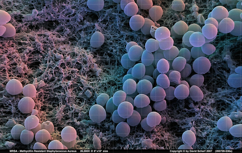 1 staphylococcus aureus